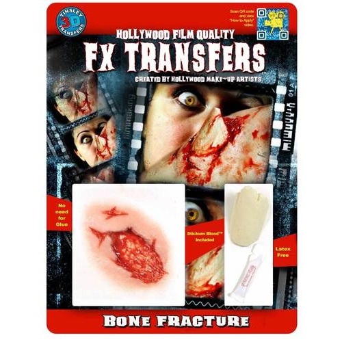Bone Fracture - TInsley 3D Fx Transfers